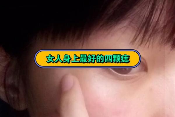 他身上那颗痣，竟预示着非凡命运！
