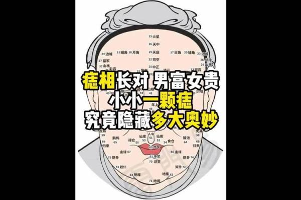 额头痣的奥秘：正中位置预示着怎样的命运？