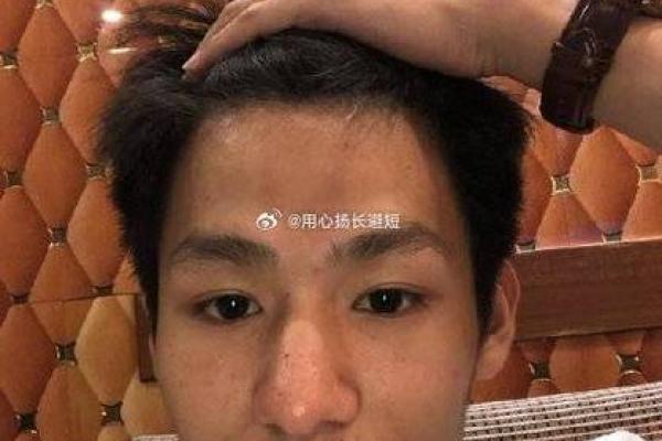 额头窄小面相运势揭秘