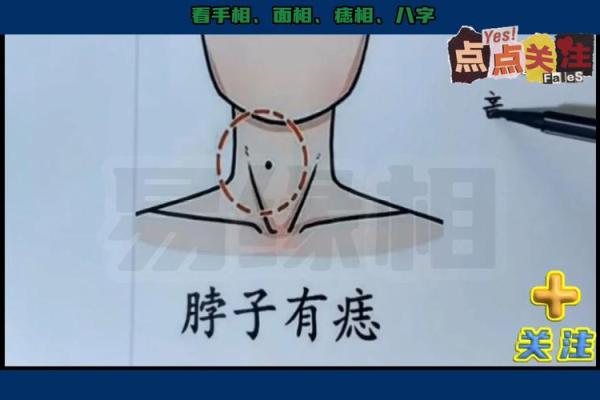 后脖颈的神秘印记：女性痣相的秘密解析